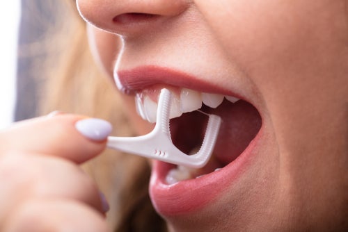 Do you need to floss your teeth?